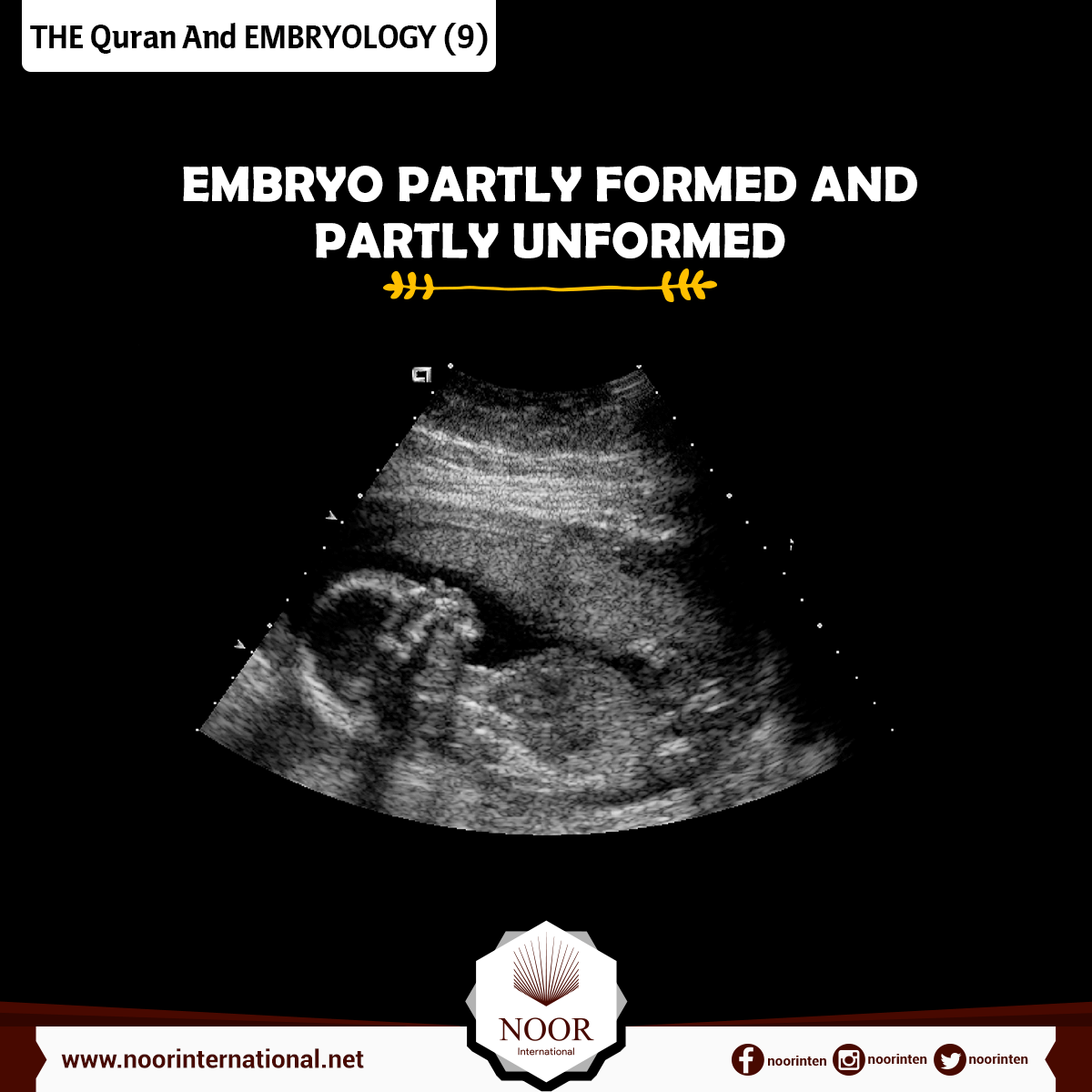 THE Quran And EMBRYOLOGY ( 9 )