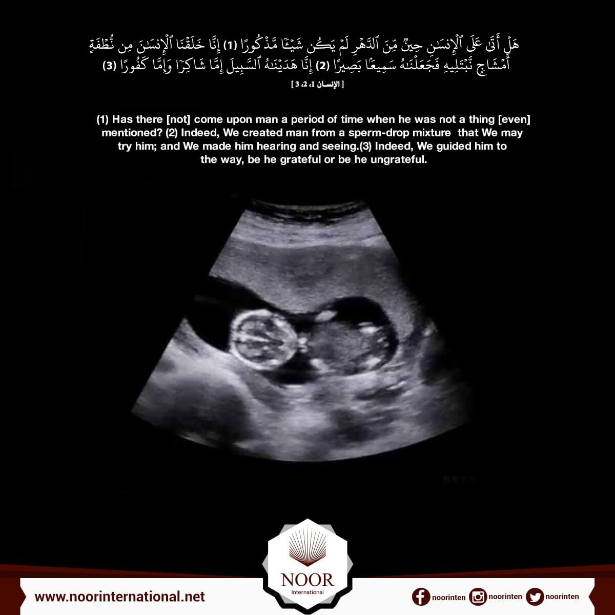 THE Quran And EMBRYOLOGY